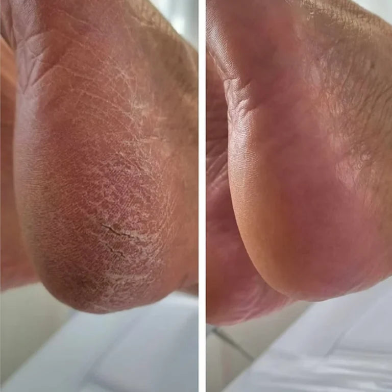 NanoGlass Foot File