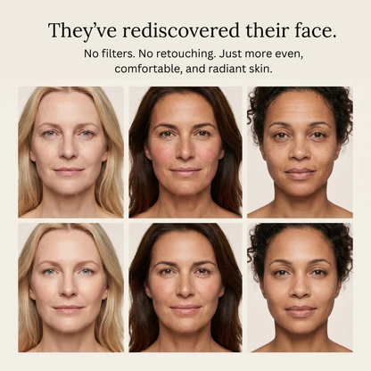 4-in-1 Foundation