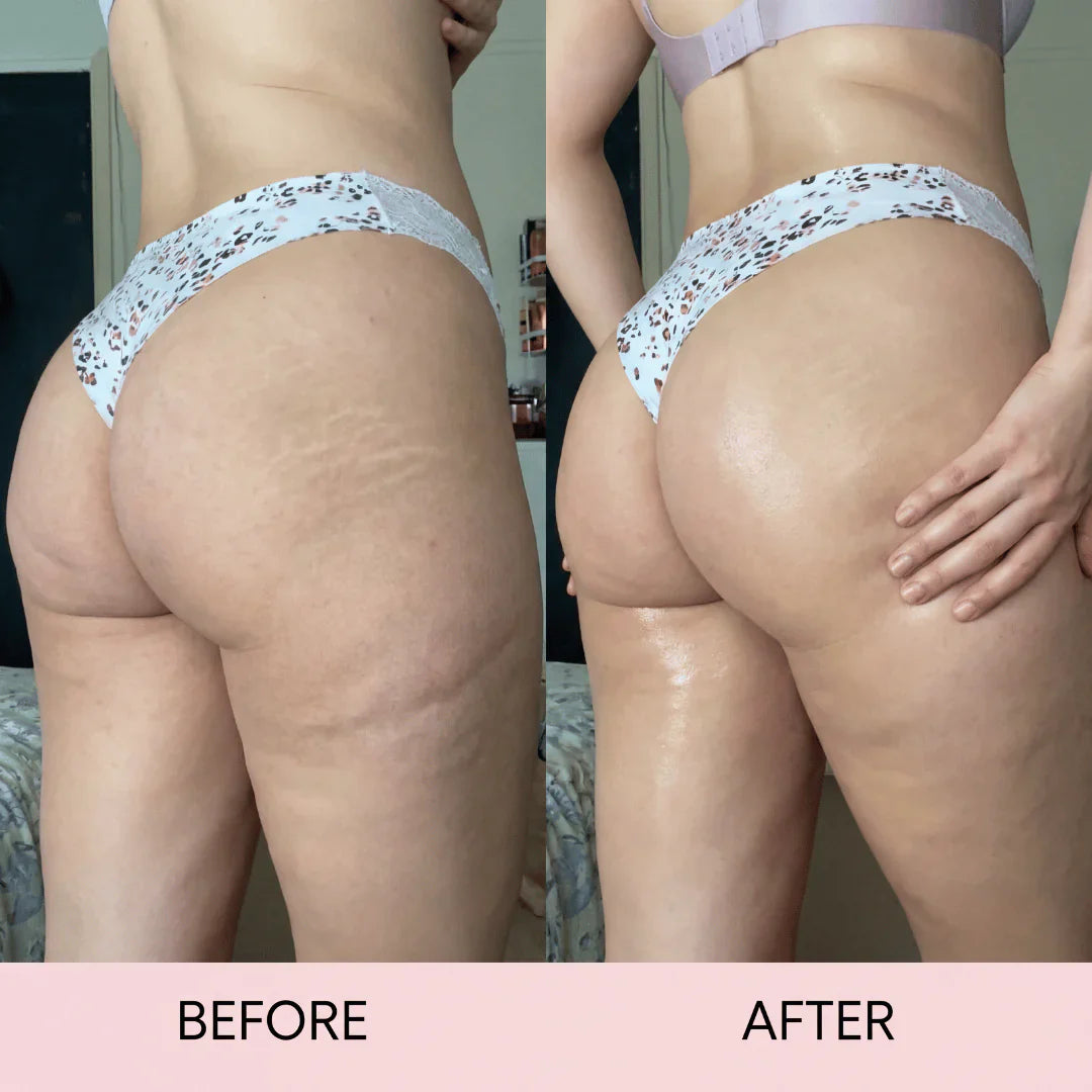Anti-Cellulite Massage Oil