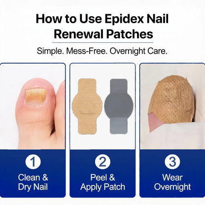 Fungal Nail Renewal Patches
